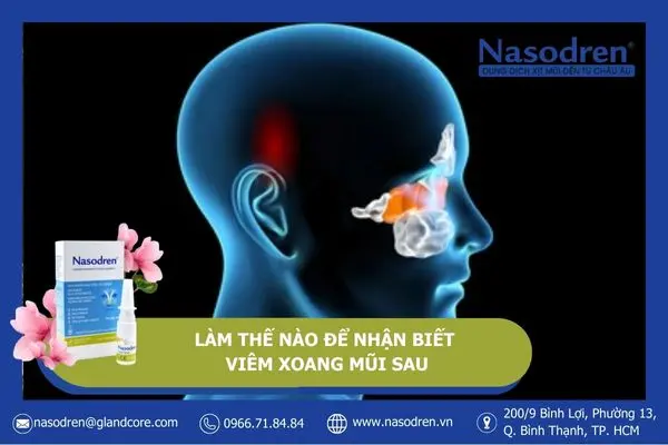 làm sao để nhận biết viêm xoang mũi sau