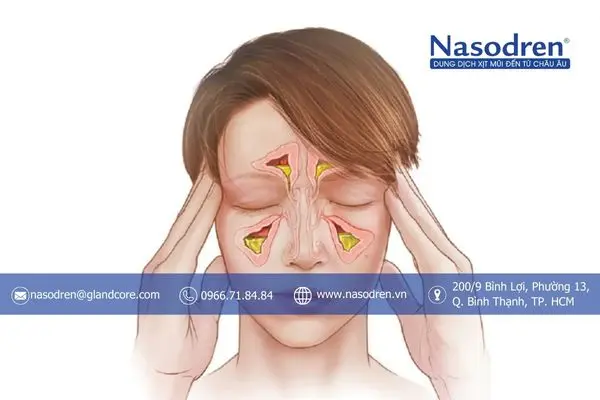 tìm hiểu về viêm xoang