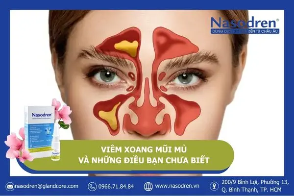 viêm xoang mũi mủ và những điều bạn chưa biết